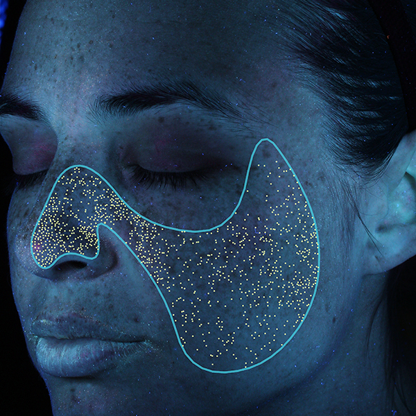 Porphyrine, California Skin, Ihre Experten für Faltenbehandlungen in München